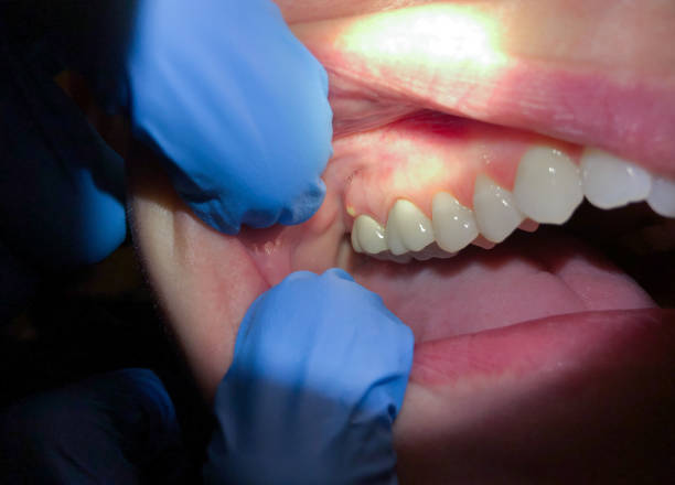 Emergency Dental Care for Trauma or Injury